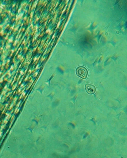 CANNABIDIOL EYE CREAM